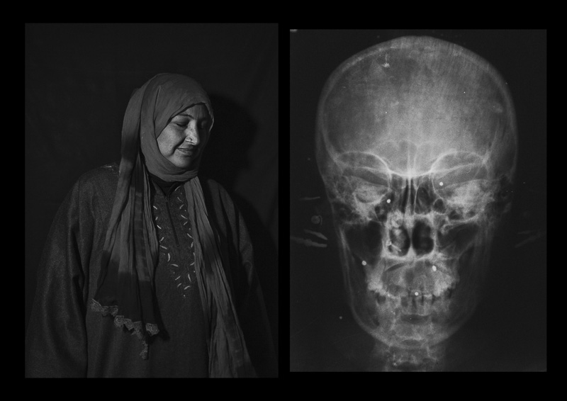 دره سایه ها - کامیلو پاسکوآرلی 5