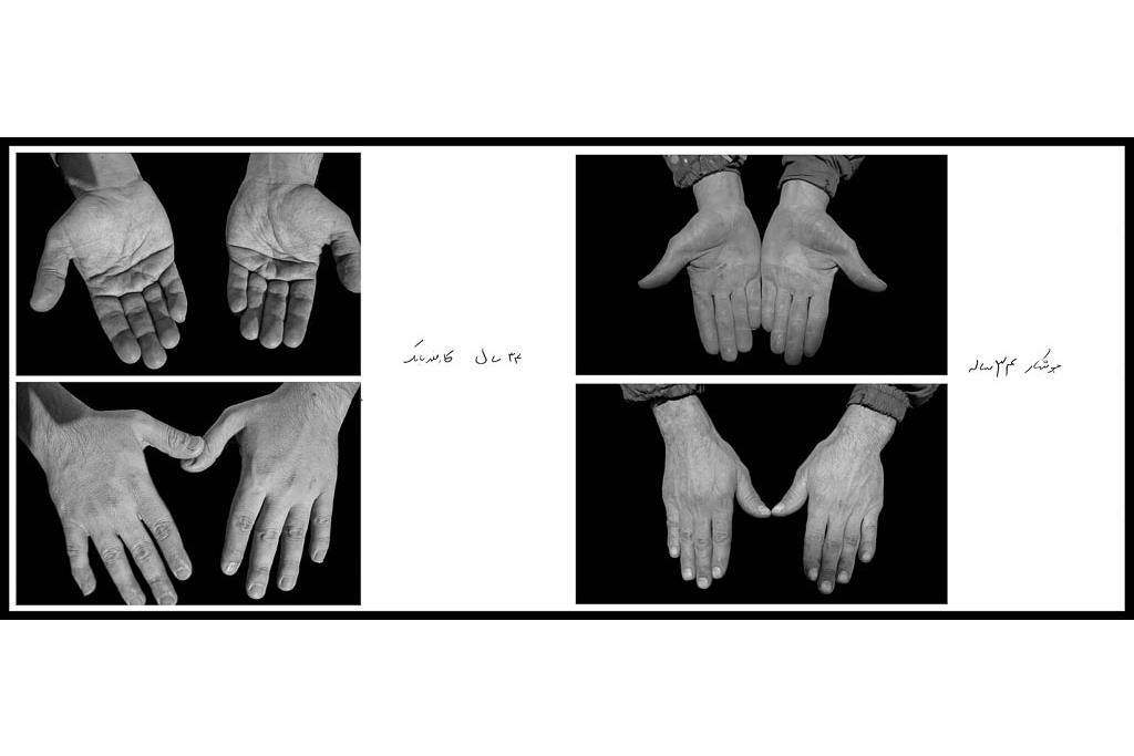 تَرَک های زیر پوستی - سیدحامد سیدمراد 11