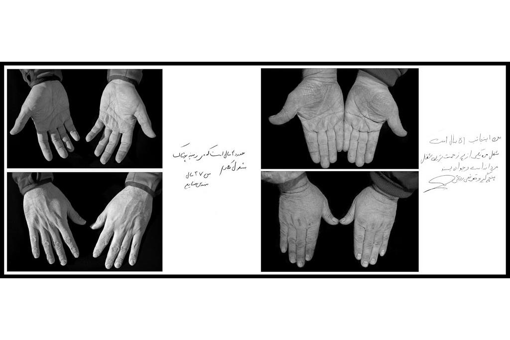 تَرَک های زیر پوستی - سیدحامد سیدمراد 10