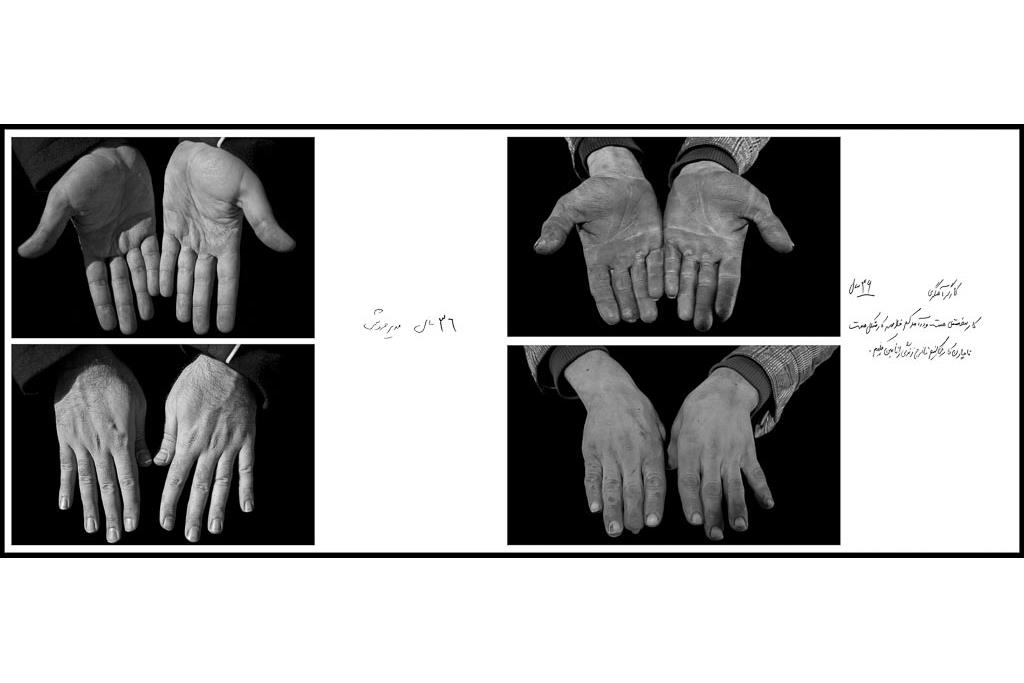 تَرَک های زیر پوستی - سیدحامد سیدمراد 8