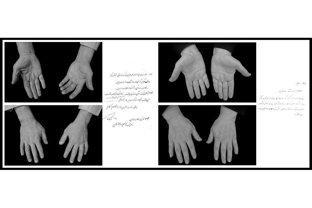 تَرَک های زیر پوستی - سیدحامد سیدمراد 2