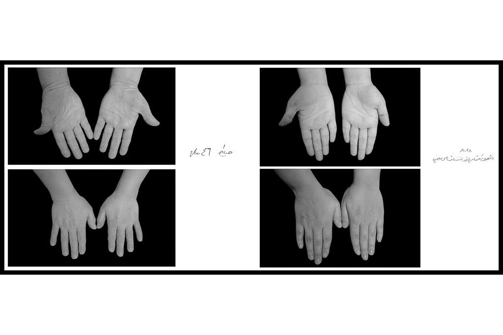 تَرَک های زیر پوستی - سیدحامد سیدمراد 7