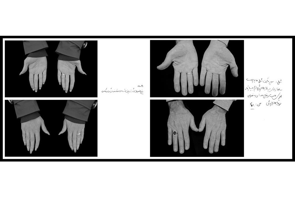 تَرَک های زیر پوستی - سیدحامد سیدمراد 4