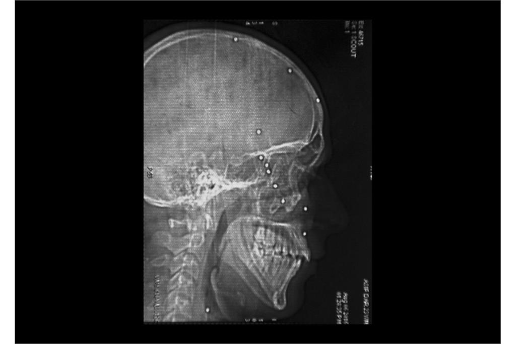 دره سایه ها - کامیلو پاسکوآرلی 9