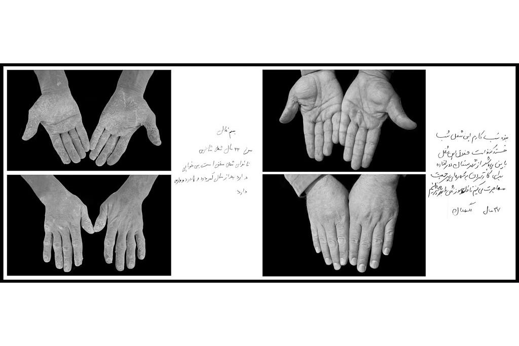 تَرَک های زیر پوستی - سیدحامد سیدمراد 9