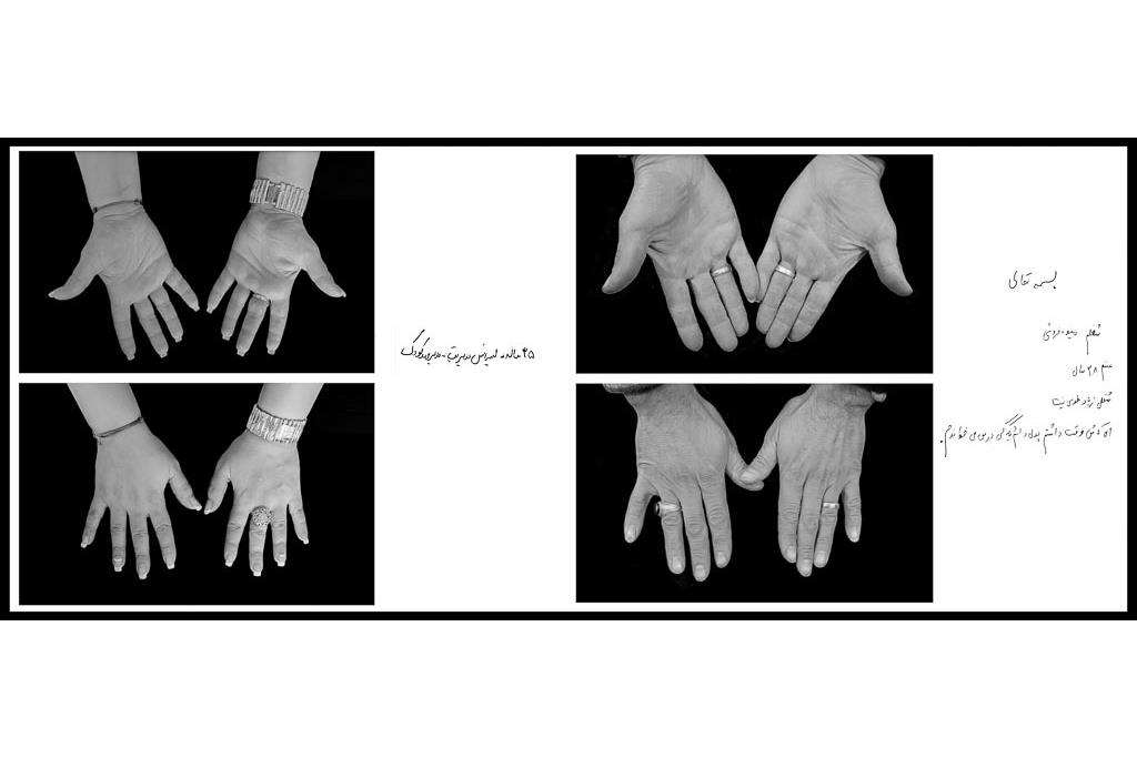 تَرَک های زیر پوستی - سیدحامد سیدمراد 3