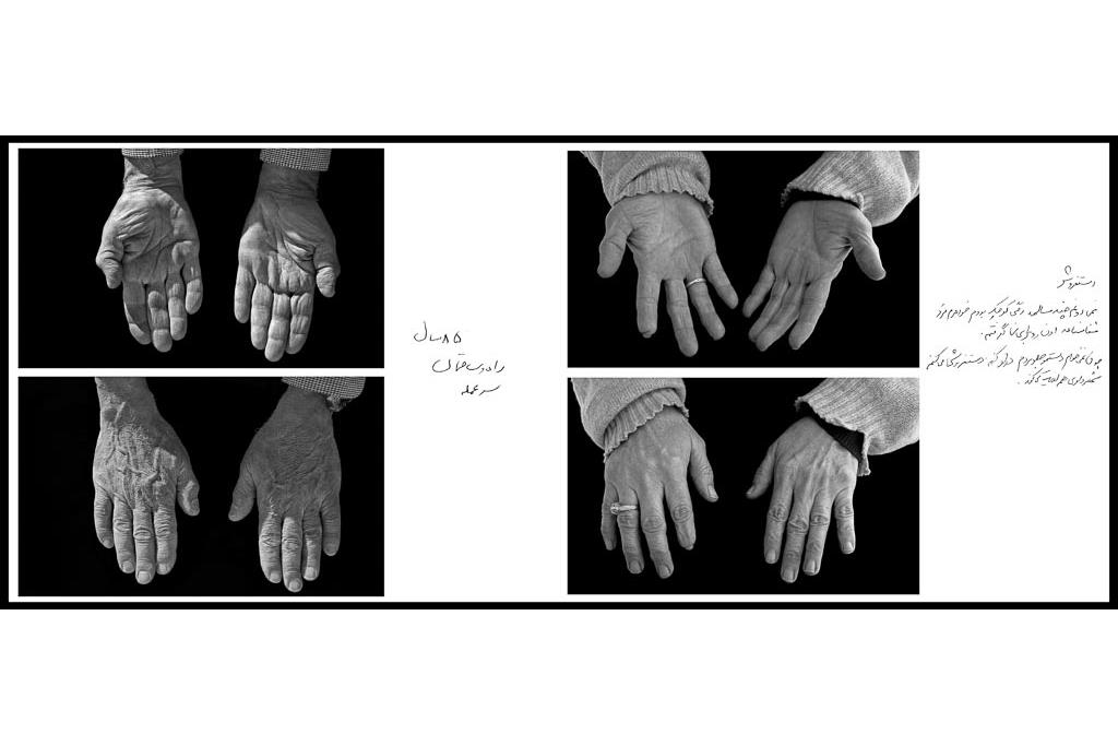 تَرَک های زیر پوستی - سیدحامد سیدمراد 12