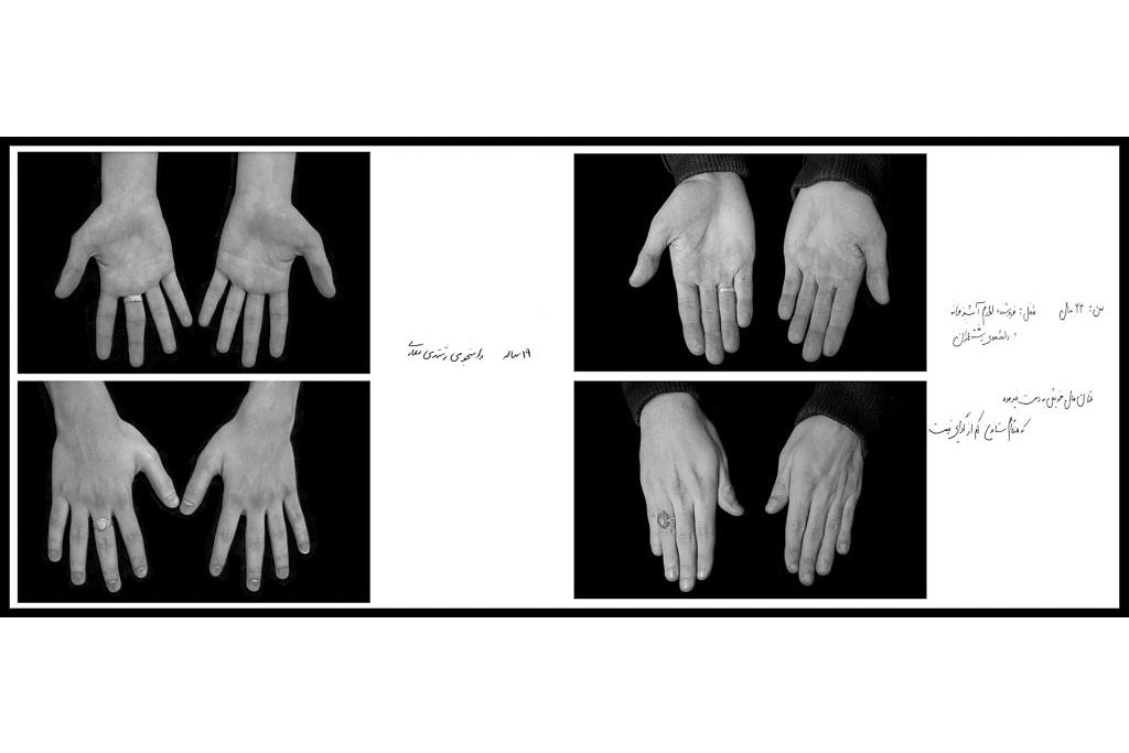 تَرَک های زیر پوستی - سیدحامد سیدمراد 5