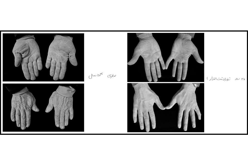 تَرَک های زیر پوستی - سیدحامد سیدمراد 1