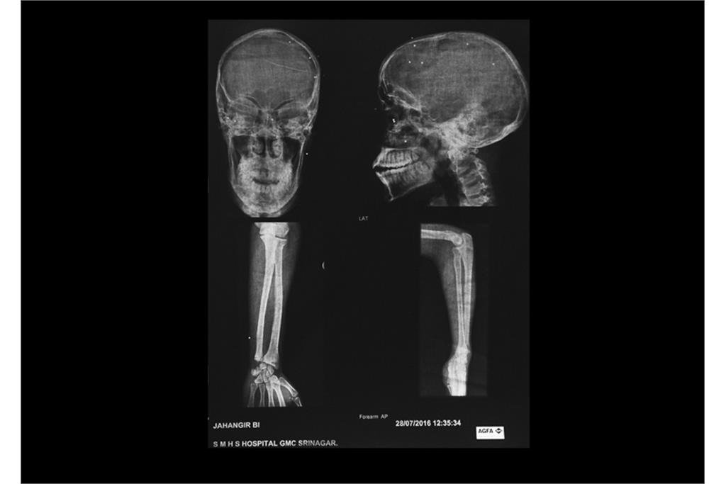 دره سایه ها - کامیلو پاسکوآرلی 4